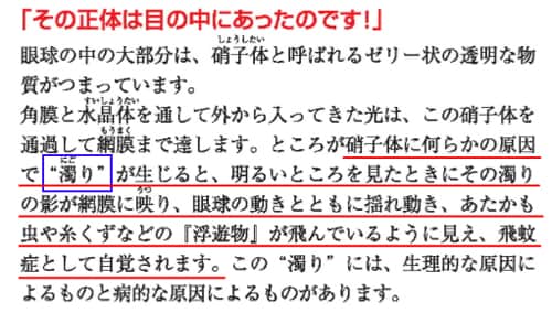 飛蚊症の症状
