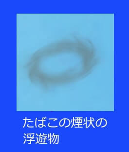 飛蚊症の見え方