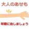 大人のあせもを薬で早く治したい！ 夏になると発症するので、その対策