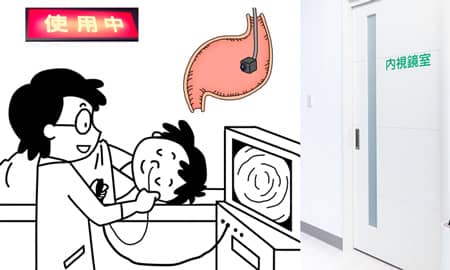 内視鏡検査中の男性